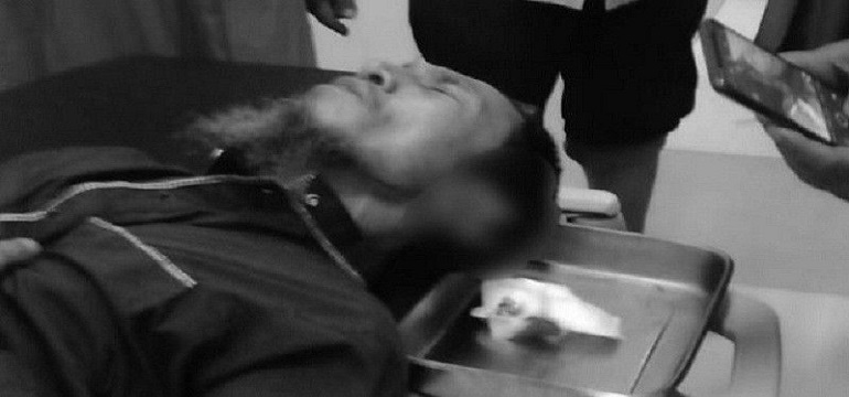 Muazin di Medan Cerita Detik-detik Kuping Disayat Jemaah hingga Nyaris Putus
