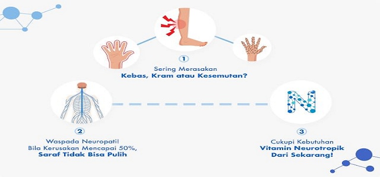 Waspadai Jika Sering Terjadi Tangan Kesemutan dan Kebas